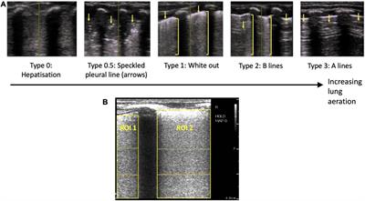 Quantifying lung aeration in neonatal lambs at birth using lung ultrasound